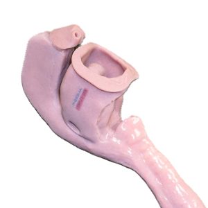 African American Base Airway (Swollen Victim)