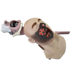 Burn Victim Skills Kit