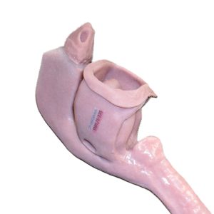 Caucasian Base Airway (Swollen Victim)