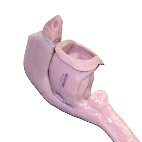 Caucasian Base Airway (Swollen Victim)