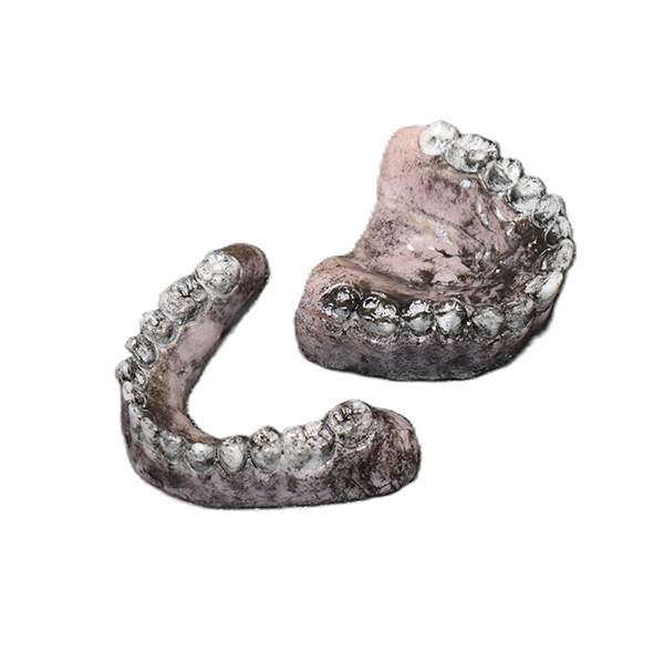 Lower Replacement Teeth (Burn Victim) - Image 2