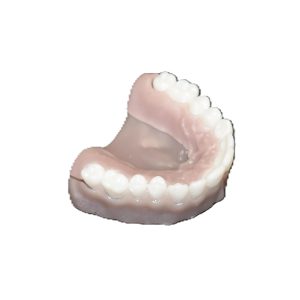 Upper Replacement Teeth