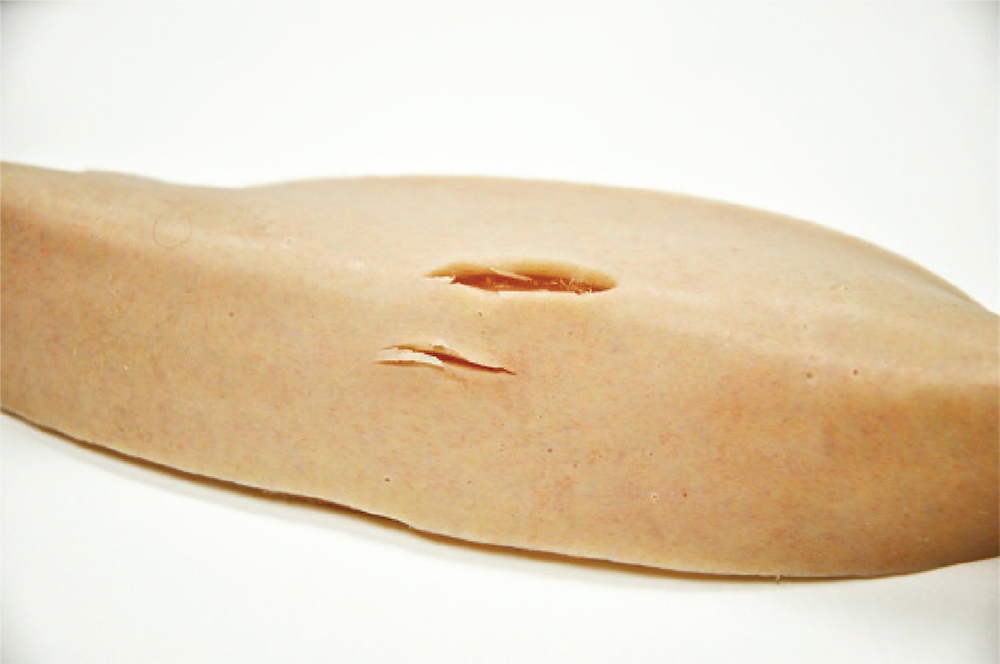 Cricoid and Suture Skin Strips (10 pk) - Image 3