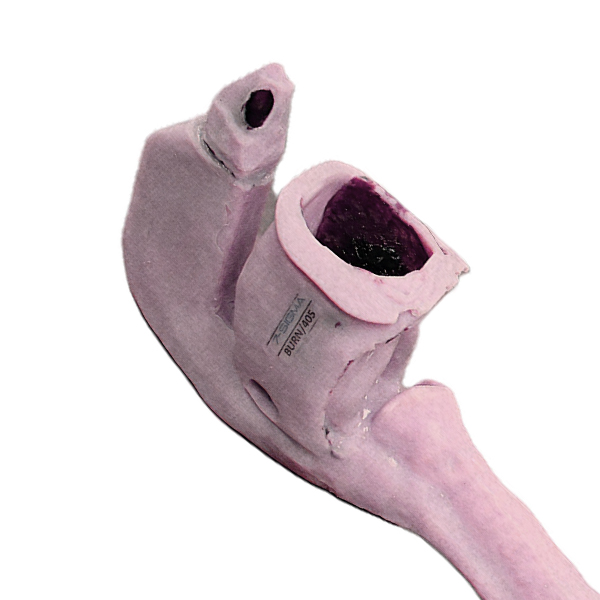 Caucasian Base Airway (Burn Victim)