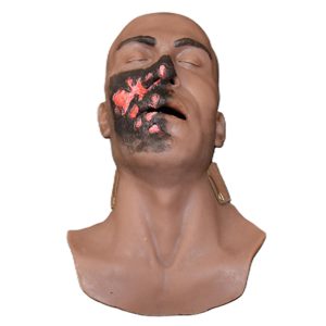 Face Skin (Burn Victim)