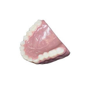 Upper Replacement Teeth (Pediatric)