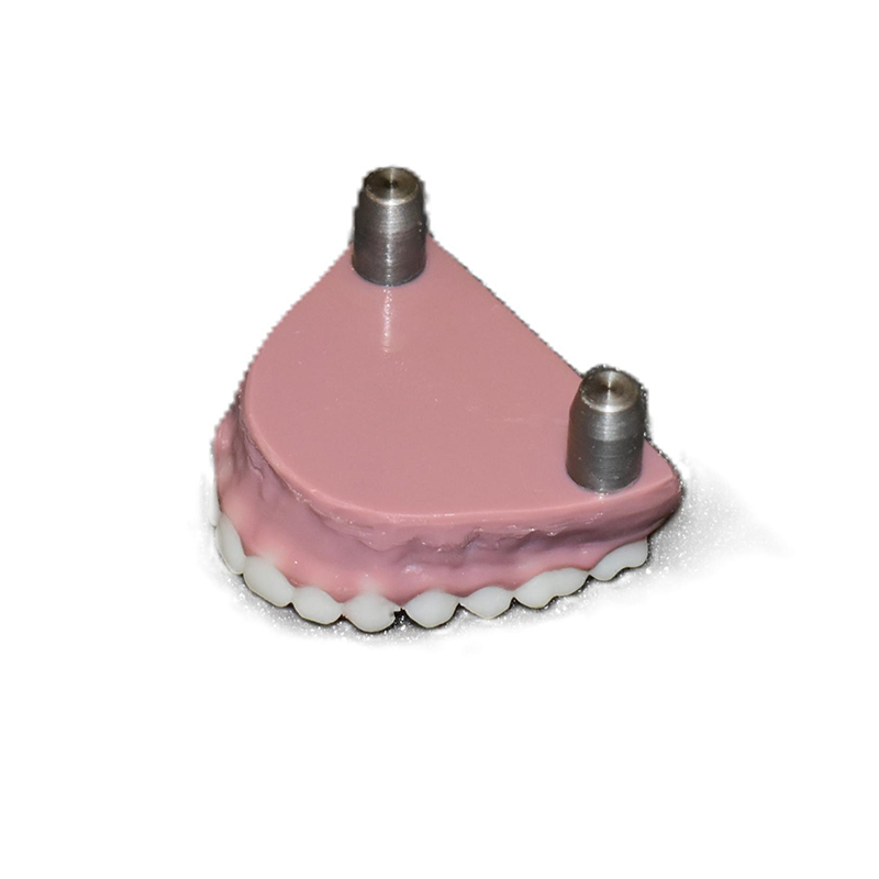 Upper Replacement Teeth (Pediatric) - Image 2